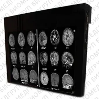 Double Black Imaging 32 MRSafe Display Медицинский монитор