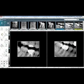 Программное обеспечение для обработки снимков зубов Visiodent