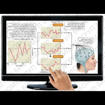 Медицинское программное обеспечение EPROBE