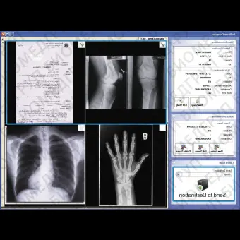 Программное обеспечение для преобразования файла DICOM Ultima