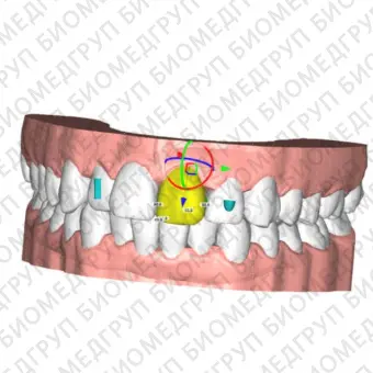 Программное обеспечение для стоматологических лабoраторий ALIGNER