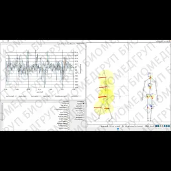 Программное обеспечение кинезитерапия H.Diagnostic