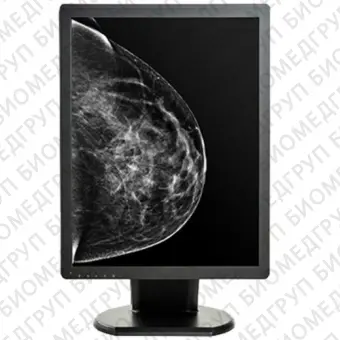 Double Black Imaging 5MP Monochrome Display For Mammography And Tomo Медицинский монитор