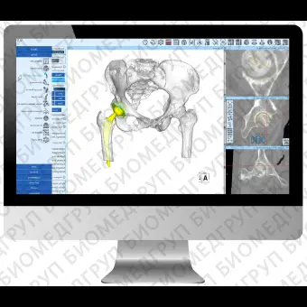 Программное обеспечение TDM ZedHip 3D