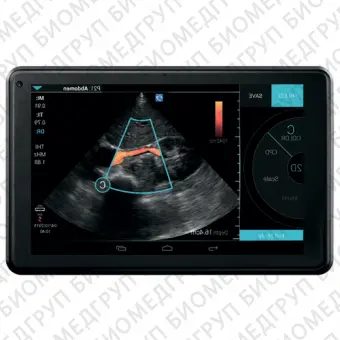 Fujifilm Sonosite iViz Аппарат УЗИ