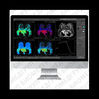 Медицинский модуль программного обеспечения Myrian XPBreast