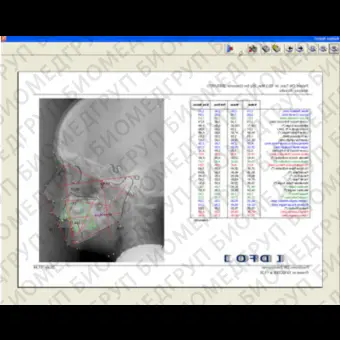 Медицинское программное обеспечение Mediadent DFO