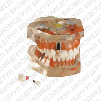 TOOTH MODEL PTYPE  прозрачная демонстрационная модель челюсти