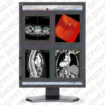 NEC MDC212C2 Медицинский монитор