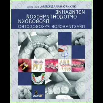 Изгибание ортодонтической проволки / Э. Накаджима