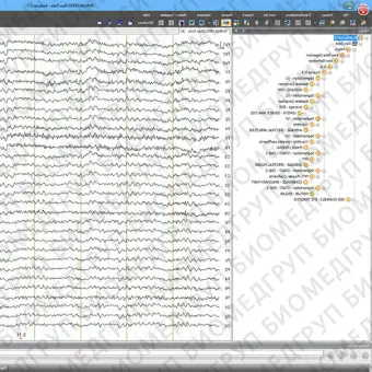 Программное обеспечение для ЭКГ Analyzer 2