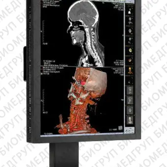 NEC MD210C2 Медицинский монитор