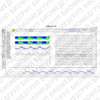 Монитор пациента для ЭКГ Sienna Ultimate ICU