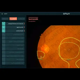 Программное обеспечение для офтальмоскопии MedFundus AI