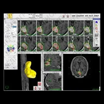 Медицинское программное обеспечение Leksell GammaPlan