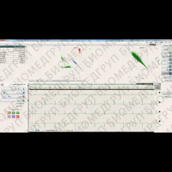 Кардиомонитор Холтера 12 каналов BTL CardioPointHolter H600