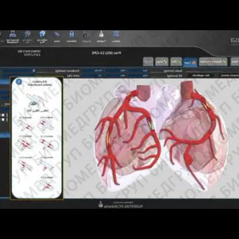 Программное обеспечение для кардиологии SUITESTENSA CVIS PACS