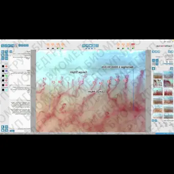 Капилляроскоп видео DM03
