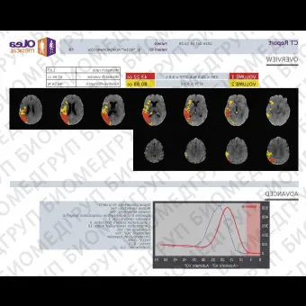 Программное обеспечение для службы экстренной помощи SPHERE 3.0 Stroke CT MR