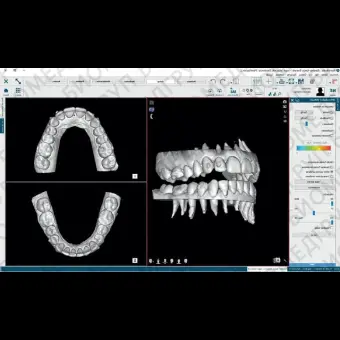 Программное обеспечение для обработки снимков зубов NemoCast