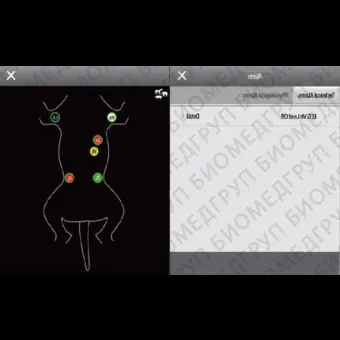Монитор пациента для ЭКГ ePM 12M Vet