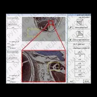 Медицинское программное обеспечение LMD