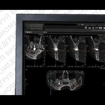 Программное обеспечение TDM TRIANA