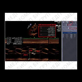 Программное обеспечение для эхокардиографии INFINITT
