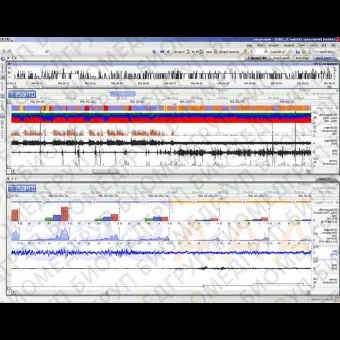 Программное обеспечение для нейрофизиологического стимулирования NeuroScore