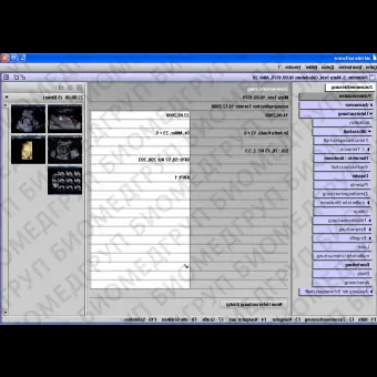 Медицинское программное обеспечение Gynaecology