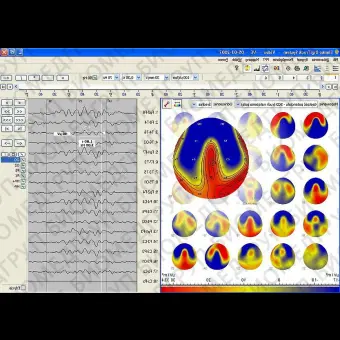 Неврологическое программное обеспечение EEG DigiTrack