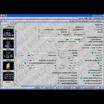 Медицинское программное обеспечение Gynaecology