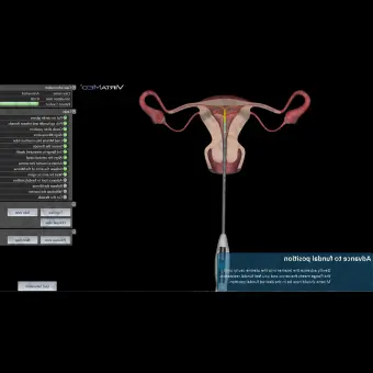 Медицинский симулятор для введения ВМС VirtaMed GynoS IUD Placement