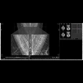Информационная рабочая станция для маммографии MammoVU