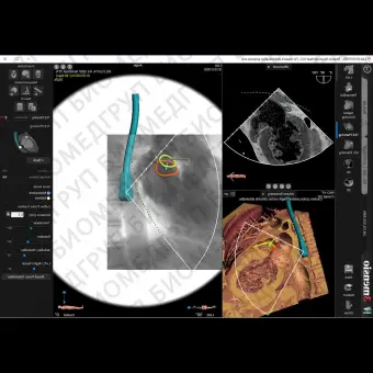 Медицинский модуль программного обеспечения 3mensio LAA