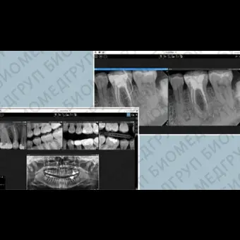 Программное обеспечение для обработки снимков зубов CS Imaging version 8