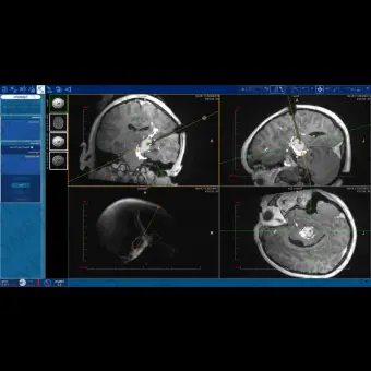 Программное обеспечение для медицинских снимков NeuroBlate  SoftwareTM NeuroBlate 