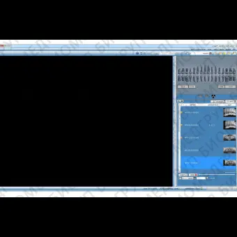 Программное обеспечение для обработки снимков зубов PROGENY