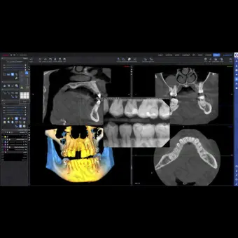 Программное обеспечение для обработки снимков зубов Planmeca Romexis 6.0
