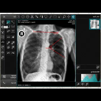 Программное обеспечение для медицинских снимков CONAXX 2