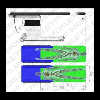 Мобильный рентгеноангиографический стол MEDINSAFIS