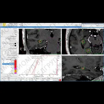 Медицинское программное обеспечение Leksell GammaPlan