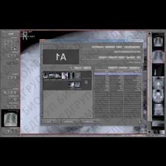 Программное обеспечение для медицинских снимков dicomPACSDXR
