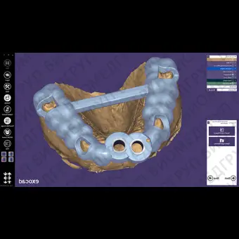 Клиническое программное обеспечение exocad 