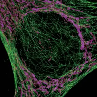 NSIM Система высокого разрешения серии SuperResolution