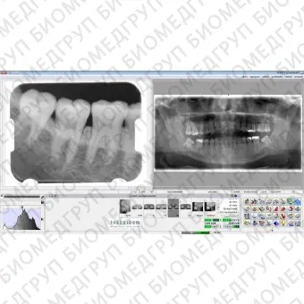 Программное обеспечение для обработки снимков зубов Mediadent