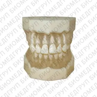 ЧВН28УП  дентомодель верхней и нижней челюстей для практики удаления зубов