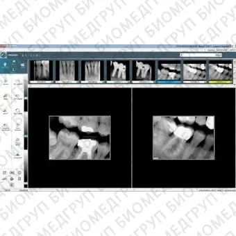 Программное обеспечение для обработки снимков зубов Visiodent