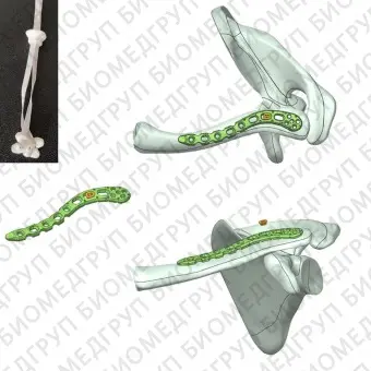 Компрессионная костная пластина для небольшого костного фрагмента HJSmall LCP 02