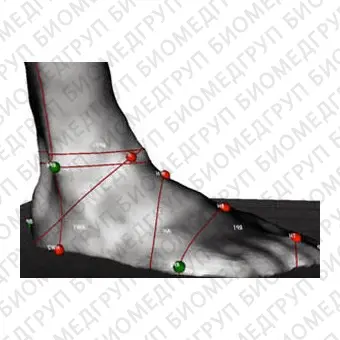 Система оценки походки Dynamic FootMorphology